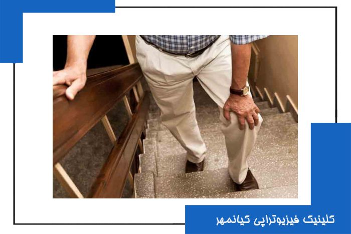 فیزیوتراپی آرتروز زانو در سیرجان