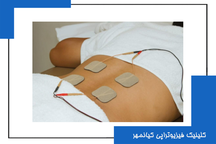 دستگاه تنس استیمولاتور